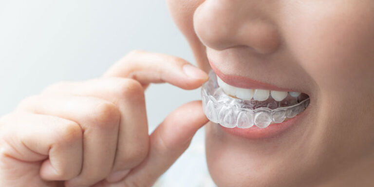woman-holding-clear-aligners-up-close-narrow