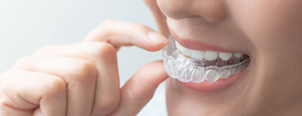 woman-holding-clear-aligners-up-close