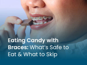 eating candy with braces