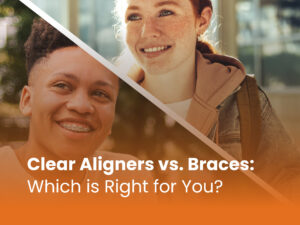 clear aligners vs braces