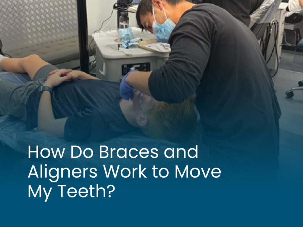 How Do Braces and Aligners Work to Move My Teeth
