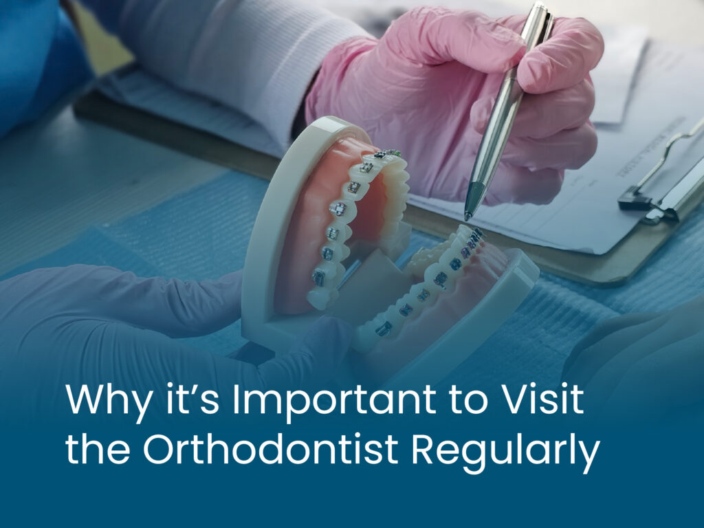 Why it's Important to Visit the Orthodontist Regularly